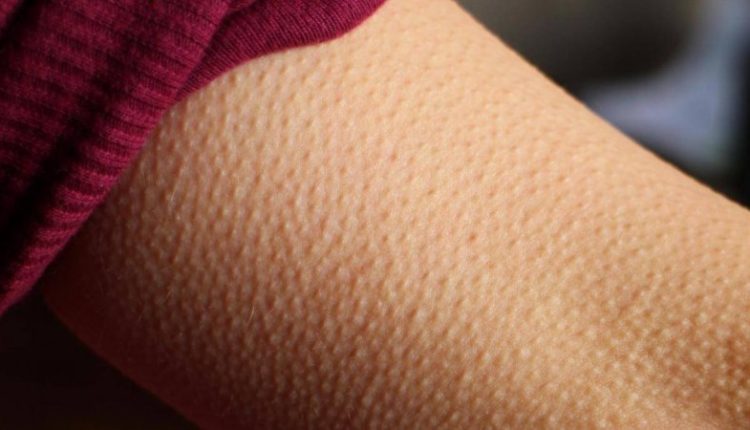 Kjo është arsyeja se pse na bëhet trupi me puçra kur emocionohemi