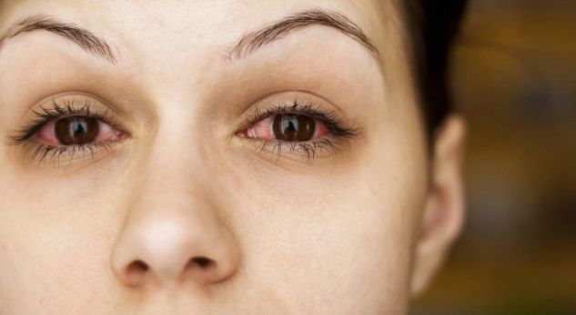 Sytë na tregojnë prej çfarë sëmundjesh vuajmë