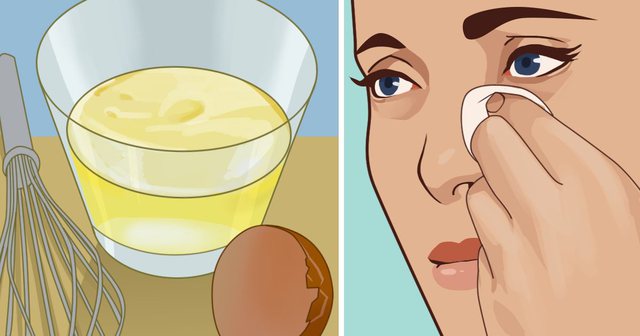 4 receta natyrale që do t’ju ulin fryrjen dhe dhimbjen e syve pas një dite të lodhshme