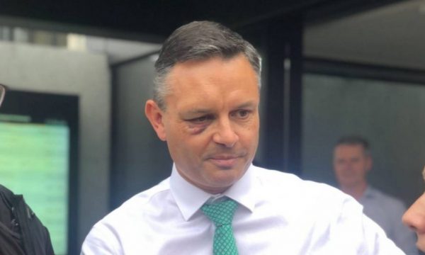 Sulmohet me grusht në fytyrë ministri në Zelandën e Re