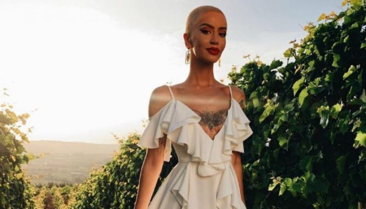 Dafina Zeqiri zbulon për herë të parë se ka gjashtë defekte trupore: Nga hunda deri te të pasmet e vogëla