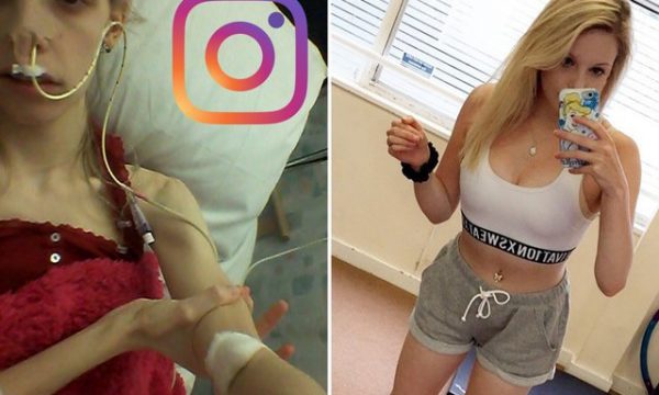 ”Jeta ime u shkatërrua nga modelet e Instagramit”, 20 vjeçarja rrëfen si përfundoi me 34 kg nga rrjetet sociale