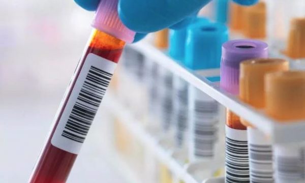 Testi i ri i gjakut po trondit njerëzit, parashikon vdekjen me saktësi të pabesueshme