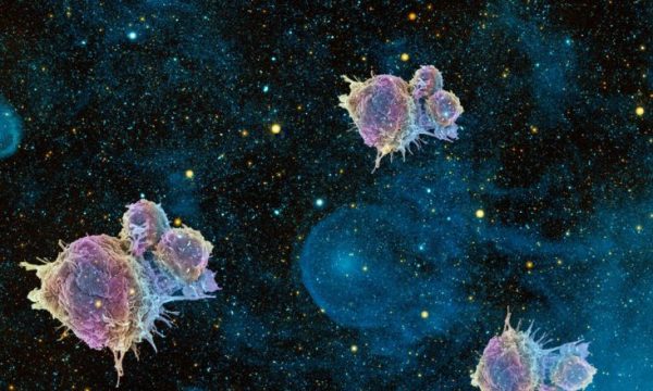 Studimi që ka shokuar botën: Qelizat e kancerit, vdesin në hapësirë!