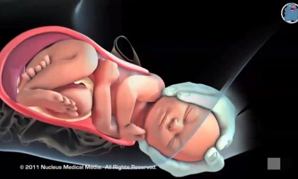 Video e shekullit: Kështu shkëputet bebja nga mitra e nënës