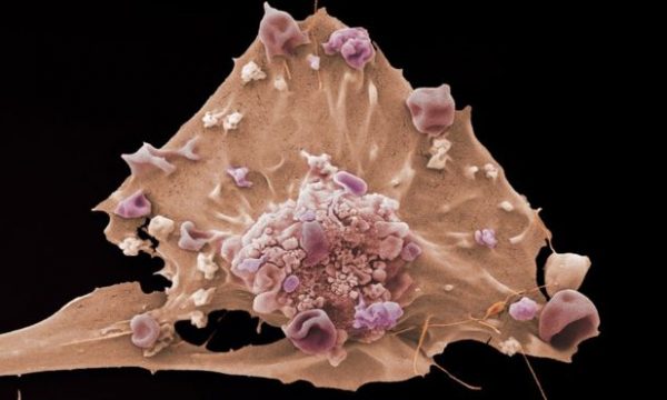 Shkencëtarët synojnë ta hulumtojnë “lindjen” e kancerit me eksperiment