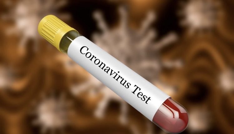 Testohet vaksina potenciale kundër koronavirusit