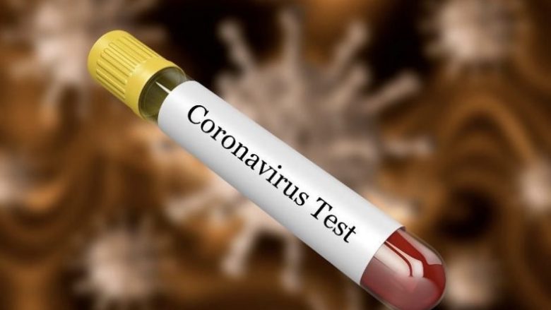 Vetëm një rast i konfirmuar me coronavirus në Maqedoni, epidemiologët sugjerojnë të mos ketë tubime edhe shtatë ditë