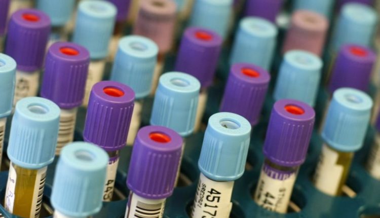 Nuk ka raste të reja të koronavirusit, testohen nëntë persona
