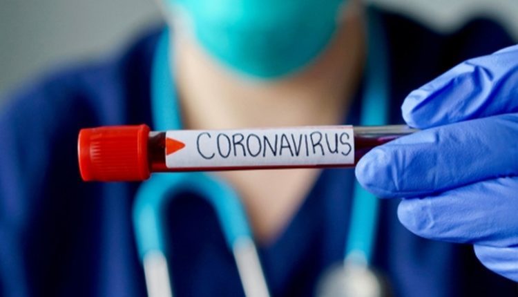 Strugë, 14 raste të reja me të prekur nga virusi Korona