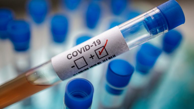 Një viktimë dhe 26 raste të reja me Covid-19 në Maqedoni