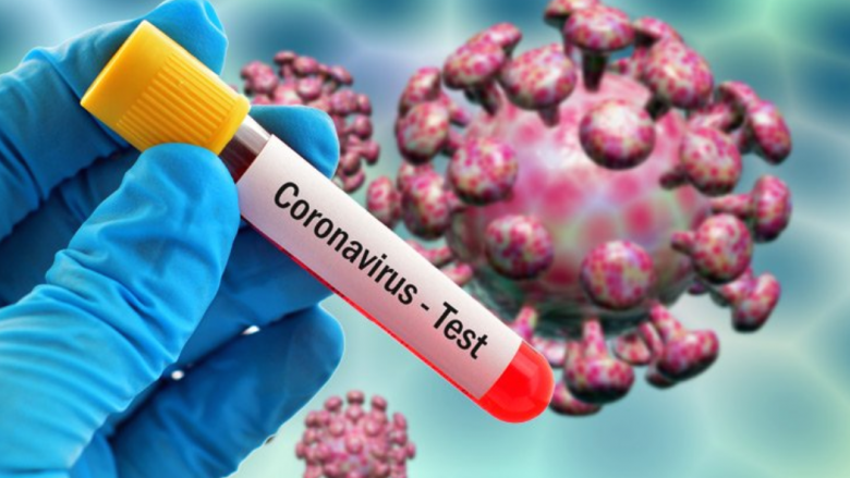 Katër viktima dhe 19 raste të reja me coronavirus në Maqedoni