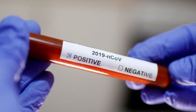 Maqedoni, 3921 raste aktive me koronavirus