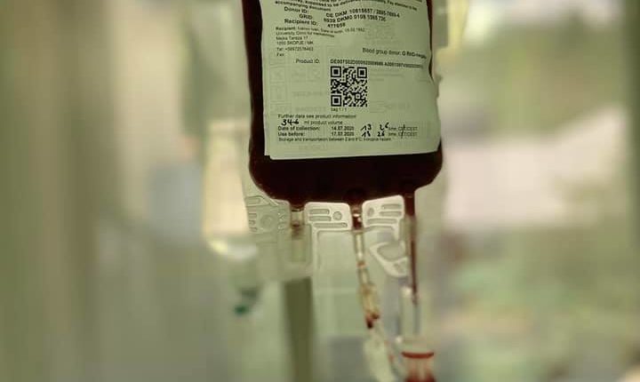 Për herë të parë është kryer transplantimi i qelizave burimore hematopoietike nga një donator tek pacienti 68 vjeçar me leukemi akute