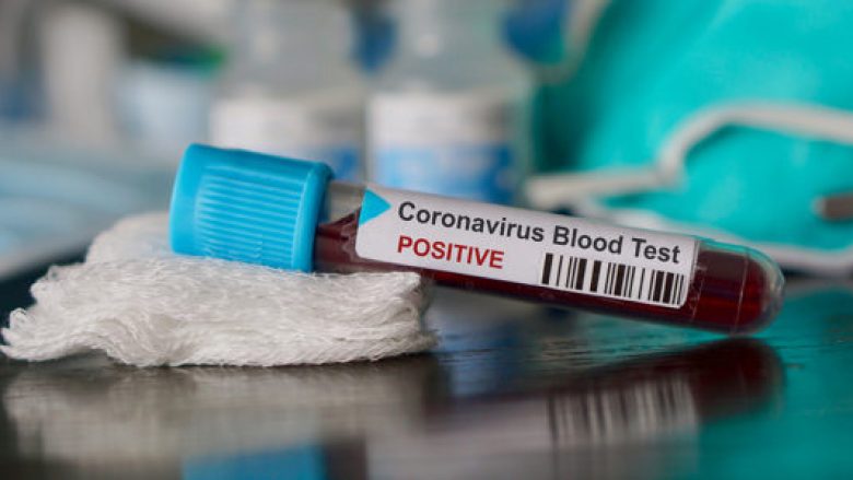 Gjithsej 3.611 raste aktive me coronavirus në Maqedoni