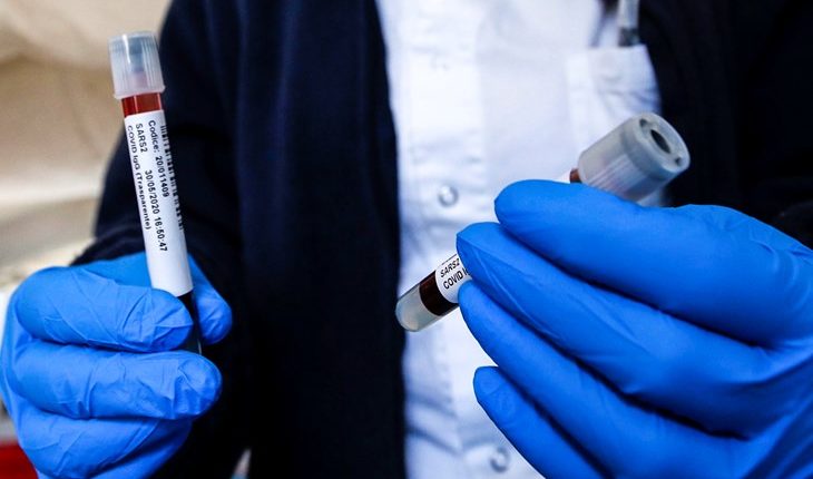 Rusia do ta testojë vaksinën kundër koronavirusit te fëmijët vitin e ardhshëm