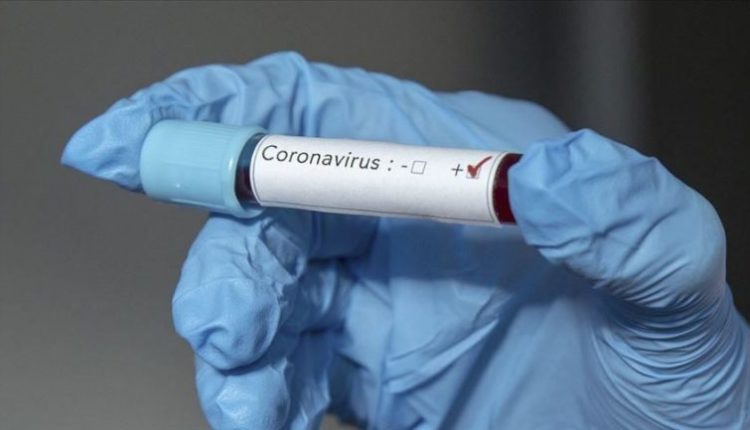 Mbërrin në Kosovë varianti britanik i koronavirusit, konfirmohen 3 rastet e para