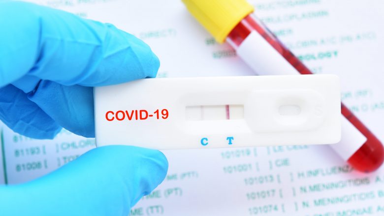 Në Maqedoni 116 persona janë infektuar për herë të dytë me coronavirus