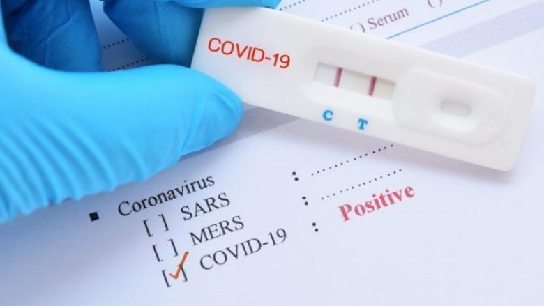 Regjistrohen 14 viktima dhe 490 raste të reja me coronavirus në Maqedoni