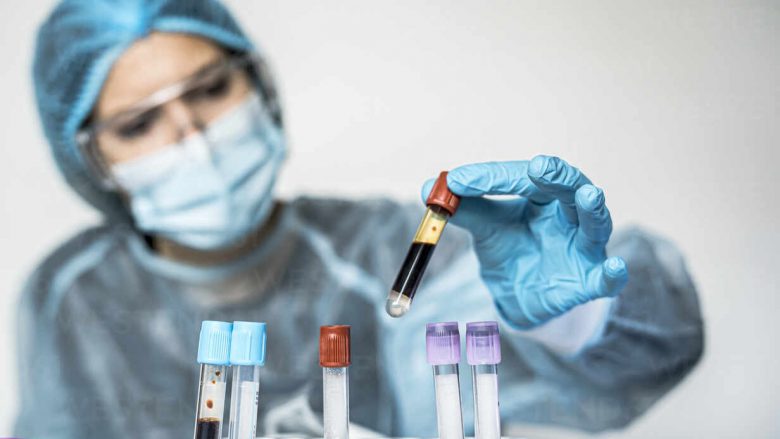 Sot 285 raste të reja me coronavirus në Maqedoni