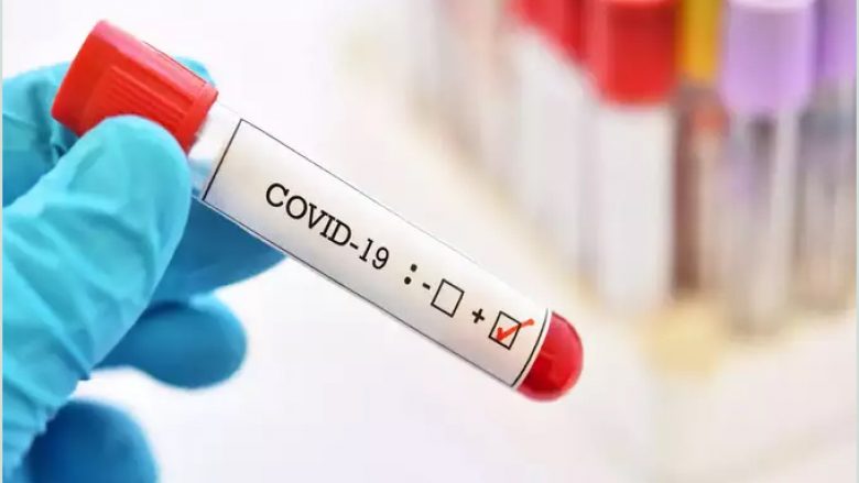 Maqedoni: Javën e kaluar pothuajse çdo i treti person i testuar ka qenë pozitiv për coronavirus