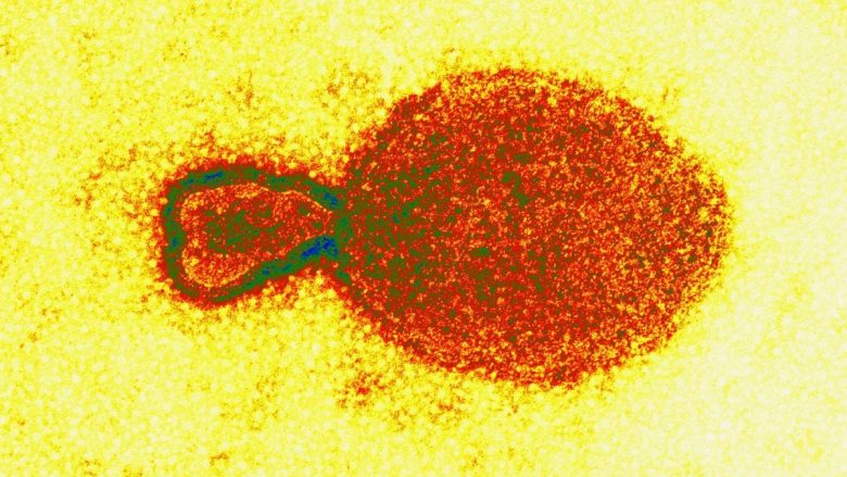 Kina po monitoron përhapjen e një “virusi të ri”, deri më tani është gjetur në 35 persona